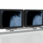 Monitor médico de rayos X del hospital