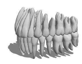 Mô hình 3d tái hấp thu chân răng giải phẫu