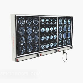 דגם תלת מימד של לוח אבחון מוח בית חולים