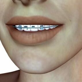 3D модель персонажа девушки с брекетами на зубах